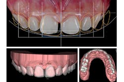 Digital Smile Design Fullsize Digital Smile Design Fullsize