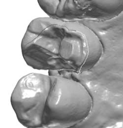 18jan25bcganci02 18jan25bcganci02