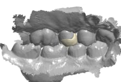 18jan25bcganci07 18jan25bcganci07