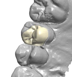 18jan25bcganci08 18jan25bcganci08