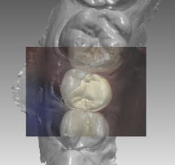 18jan25bcganci10 18jan25bcganci10