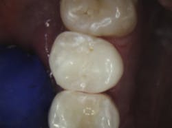 18jan25bcganci11 18jan25bcganci11