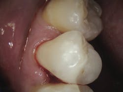 18jan25bcganci12 18jan25bcganci12