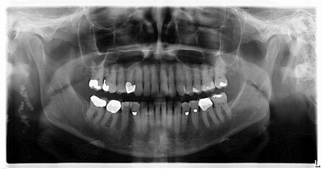 18jan25bcpath33 P01