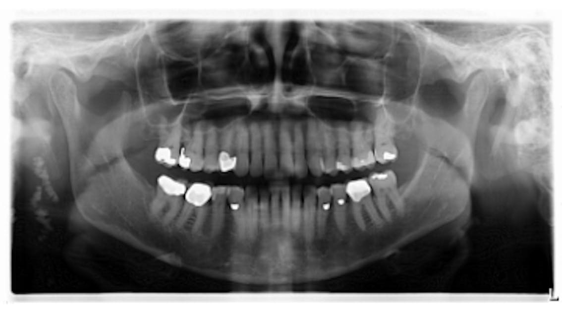 Breakthrough Clinical Oral Pathology Case No 33 Dentistry Iq