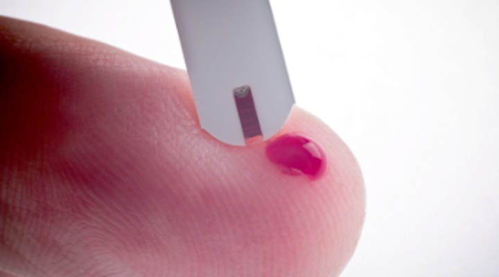 Content Dam Diq Online Articles 2018 01 Nagelbergdiabetesperiolinkt