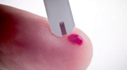 Content Dam Diq Online Articles 2018 01 Nagelbergdiabetesperiolinkt Content Dam Diq Online Articles 2018 01 Nagelbergdiabetesperiolinkt