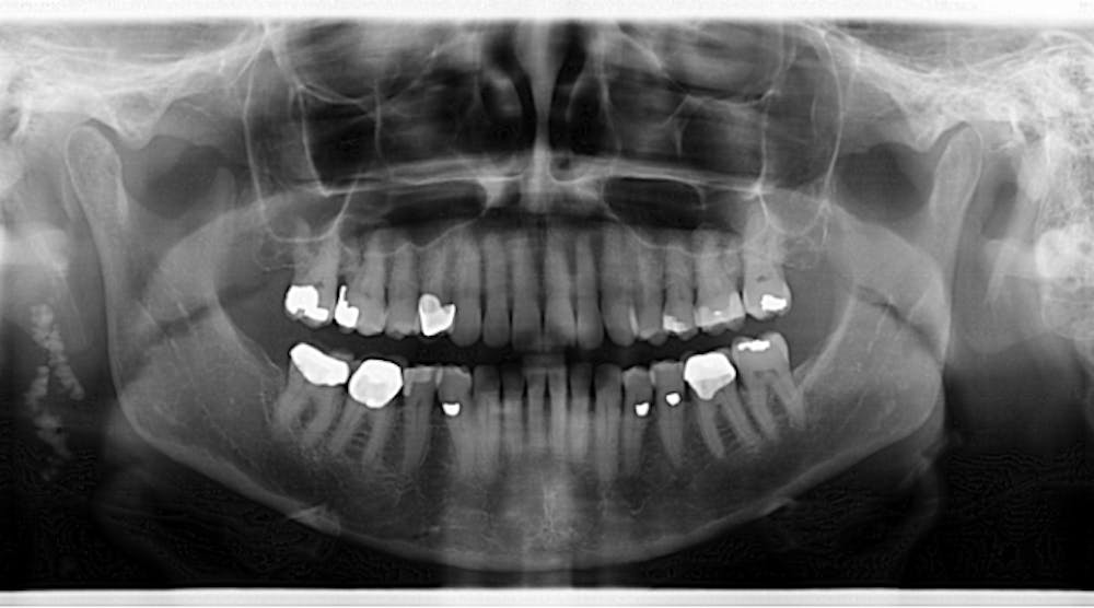 Diagnosis and treatment for Breakthrough Clinical oral pathology case ...