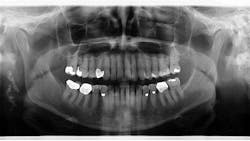 18feb22bcpath33dx01 18feb22bcpath33dx01