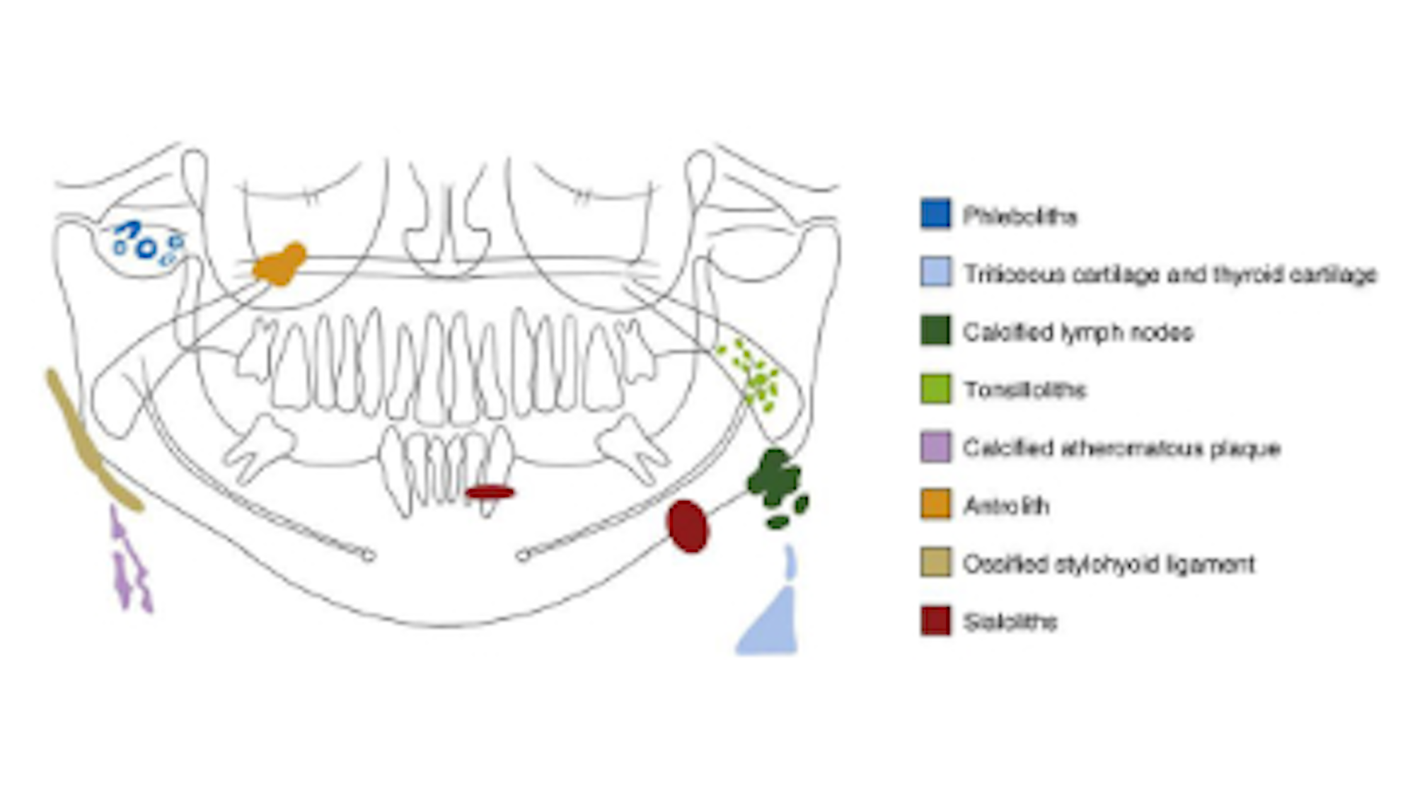Diagnosis and treatment for Breakthrough Clinical oral pathology case ...