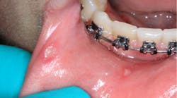 Content Dam Diq Online Articles 2018 03 18mar22bcpath34dxt Content Dam Diq Online Articles 2018 03 18mar22bcpath34dxt