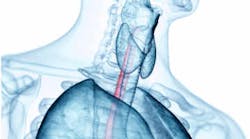 Content Dam Diq Online Articles 2018 03 Esophagus Cancer Thumb Content Dam Diq Online Articles 2018 03 Esophagus Cancer Thumb