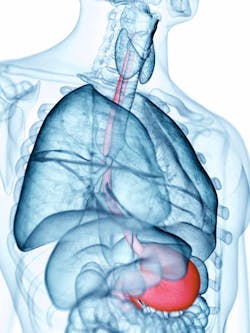 Esophagus Cancer Esophagus Cancer