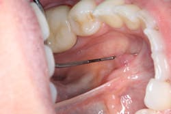 18apr26bcpath35dx01 18apr26bcpath35dx01