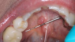 Content Dam Diq Online Articles 2018 04 18apr26bcpath35dxt Content Dam Diq Online Articles 2018 04 18apr26bcpath35dxt