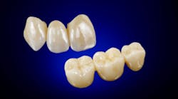 Content Dam Diq Online Articles 2018 04 Whipmix Vericore Diqthumb Content Dam Diq Online Articles 2018 04 Whipmix Vericore Diqthumb