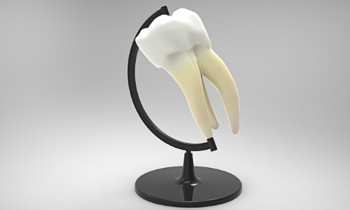 Using Laser Technology To Treat Periodontal Diseases Dentistryiq