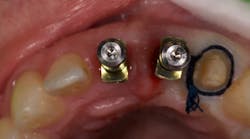 Content Dam Diq Online Articles 2018 05 18may24bcmeekt Content Dam Diq Online Articles 2018 05 18may24bcmeekt