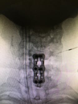 Fusion2msh Fusion2msh