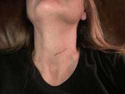 Postop3msh Postop3msh