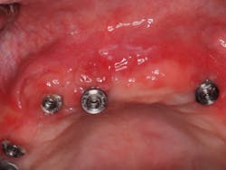 18jun28bchodges03 18jun28bchodges03