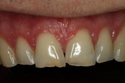 18jun28bcspringer01 18jun28bcspringer01