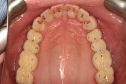 18jun28bcspringer03 18jun28bcspringer03