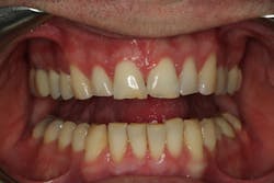 18jun28bcspringer04 18jun28bcspringer04