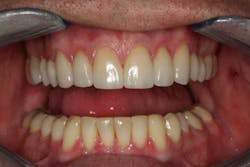 18jun28bcspringer05 18jun28bcspringer05