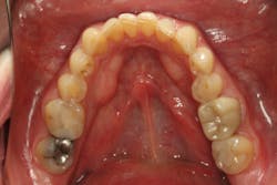 18jun28bcspringer06 18jun28bcspringer06