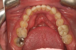 18jun28bcspringer07 18jun28bcspringer07