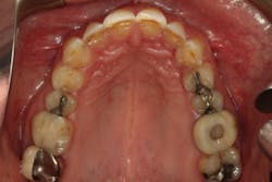 18jun28bcspringer08 18jun28bcspringer08