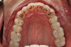 18jun28bcspringer09 18jun28bcspringer09