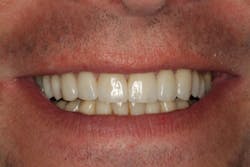 18jun28bcspringer11 18jun28bcspringer11