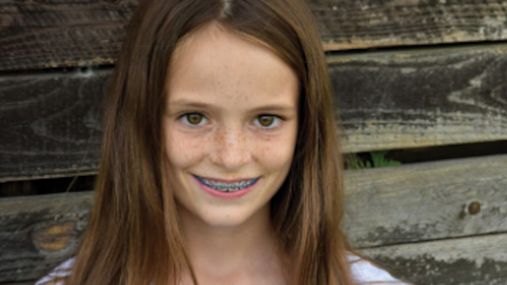 Content Dam Diq Online Articles 2018 06 Orthodontics 1
