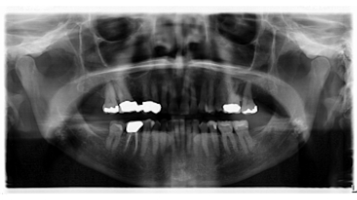 Content Dam Diq Online Articles 2018 07 18jul26bcpath37thumb