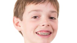 Content Dam Diq Online Articles 2018 07 Braces 1 Content Dam Diq Online Articles 2018 07 Braces 1