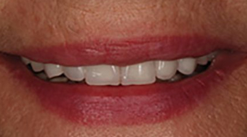 Content Dam Diq Online Articles 2018 07 Cadcam 1