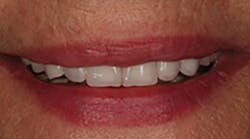 Content Dam Diq Online Articles 2018 07 Cadcam 1 Content Dam Diq Online Articles 2018 07 Cadcam 1