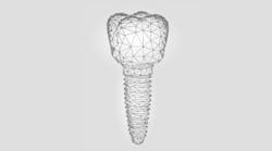 Content Dam Diq Online Articles 2018 07 Dental Implant Sales Tools Diqthumb