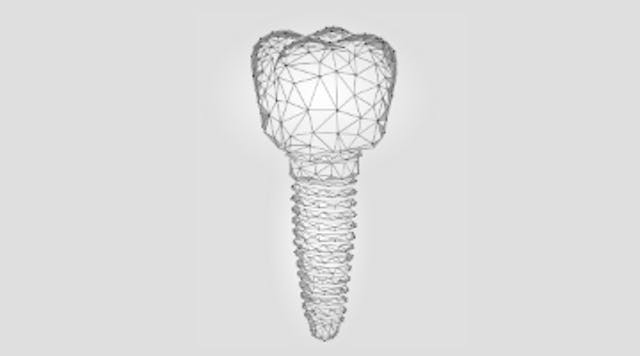 Content Dam Diq Online Articles 2018 07 Dental Implant Sales Tools Diqthumb