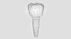 Content Dam Diq Online Articles 2018 07 Dental Implant Sales Tools Diqthumb Content Dam Diq Online Articles 2018 07 Dental Implant Sales Tools Diqthumb