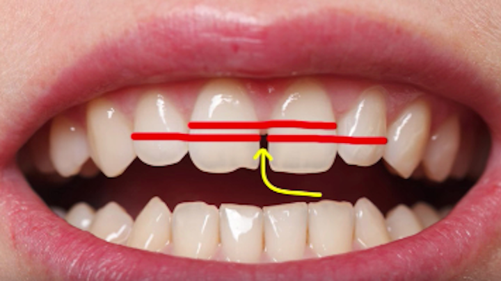 Content Dam Diq Online Articles 2018 07 Diy Dentistry