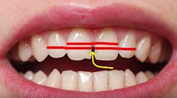 Content Dam Diq Online Articles 2018 07 Diy Dentistry Content Dam Diq Online Articles 2018 07 Diy Dentistry