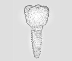 Dental Implant Sales Tools Wide Dental Implant Sales Tools Wide