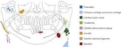 Figure 3: Calcification schematic Figure 3: Calcification schematic