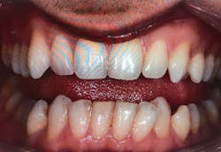 18aug23bcwilkerson02 18aug23bcwilkerson02