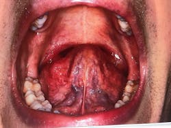 18aug23bcwilkerson07 18aug23bcwilkerson07