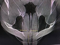 18aug23bcwilkerson08 18aug23bcwilkerson08