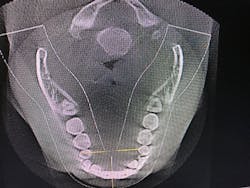 18aug23bcwilkerson09 18aug23bcwilkerson09